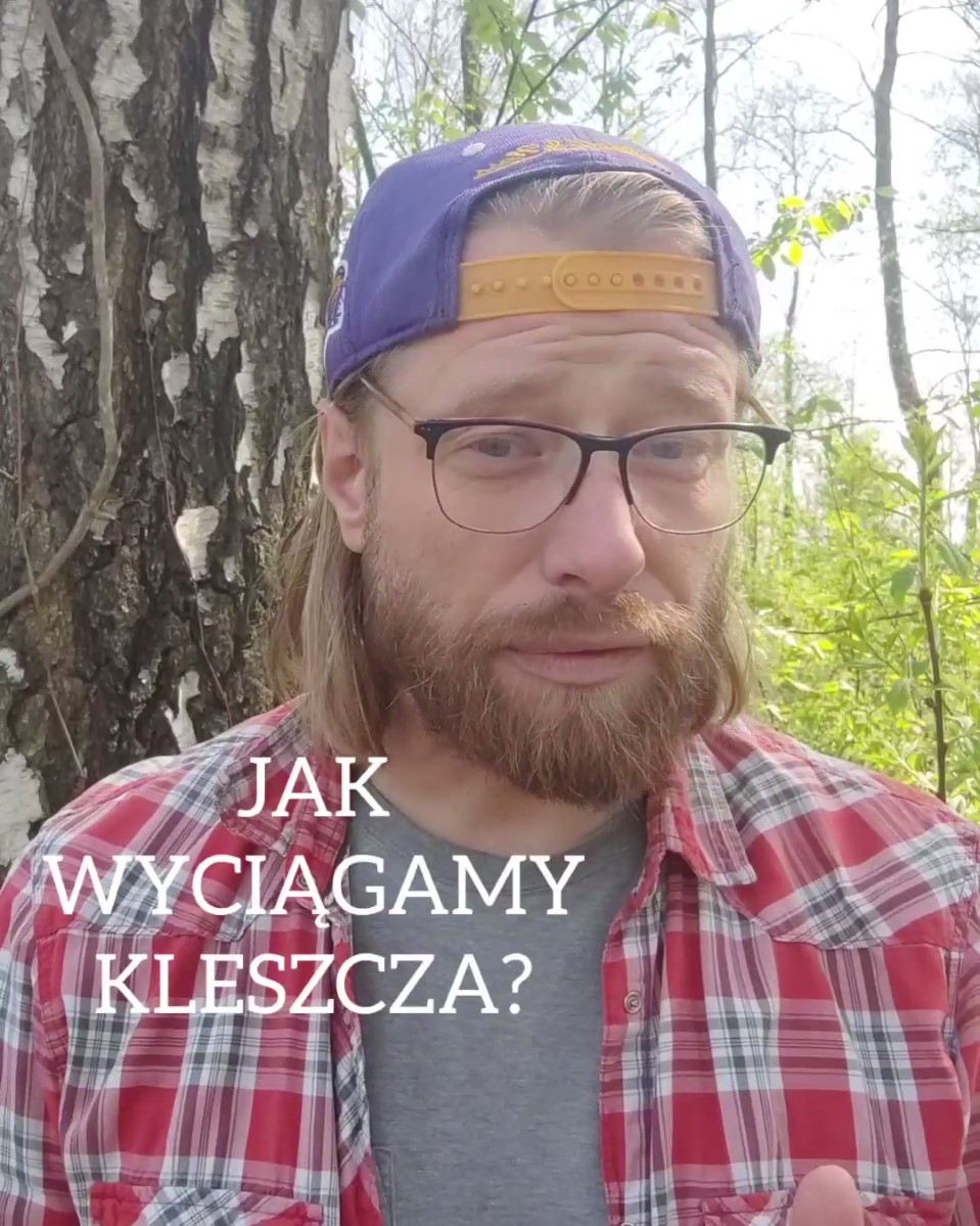 JAK WYCIĄGAMY KLESZCZA?