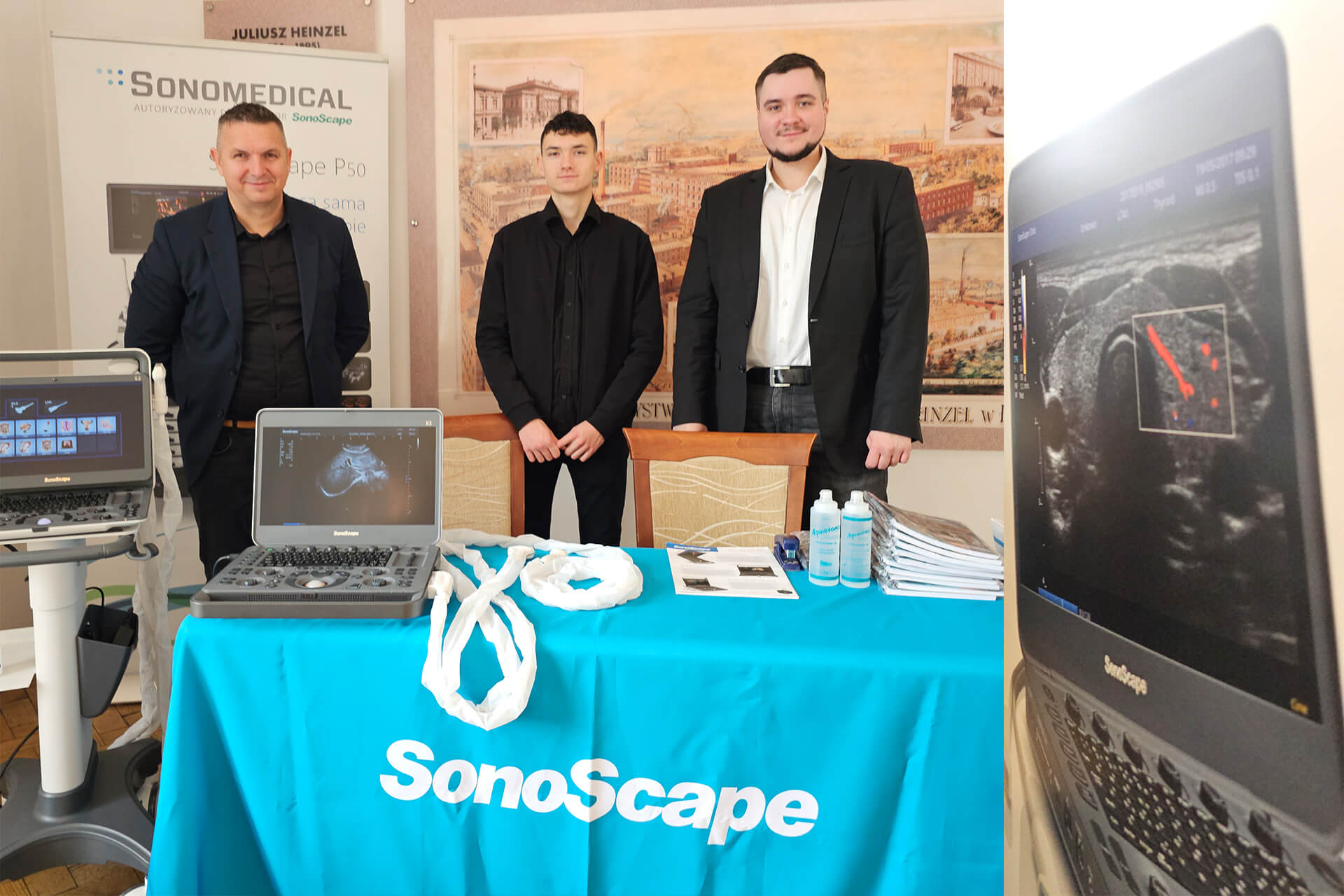 Sonoscape oferta na aparaty USG_Porozumienie Łódzkie Sonoscape oferta na aparaty USG_Porozumienie Łódzkie
