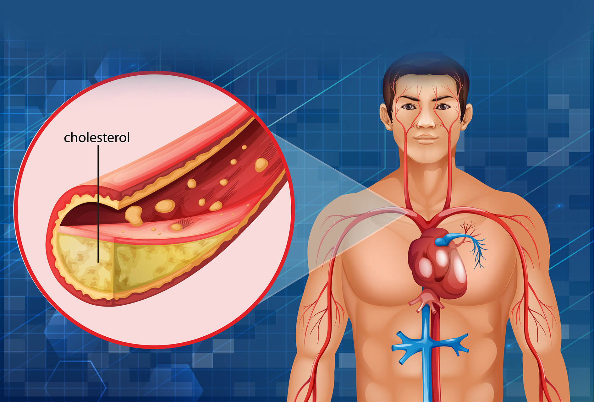 Cholesterol pod lupą_Porozumienie Łódzkie Cholesterol pod lupą